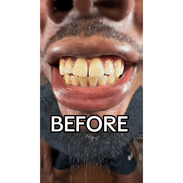 Corvex Purple Mouthwash